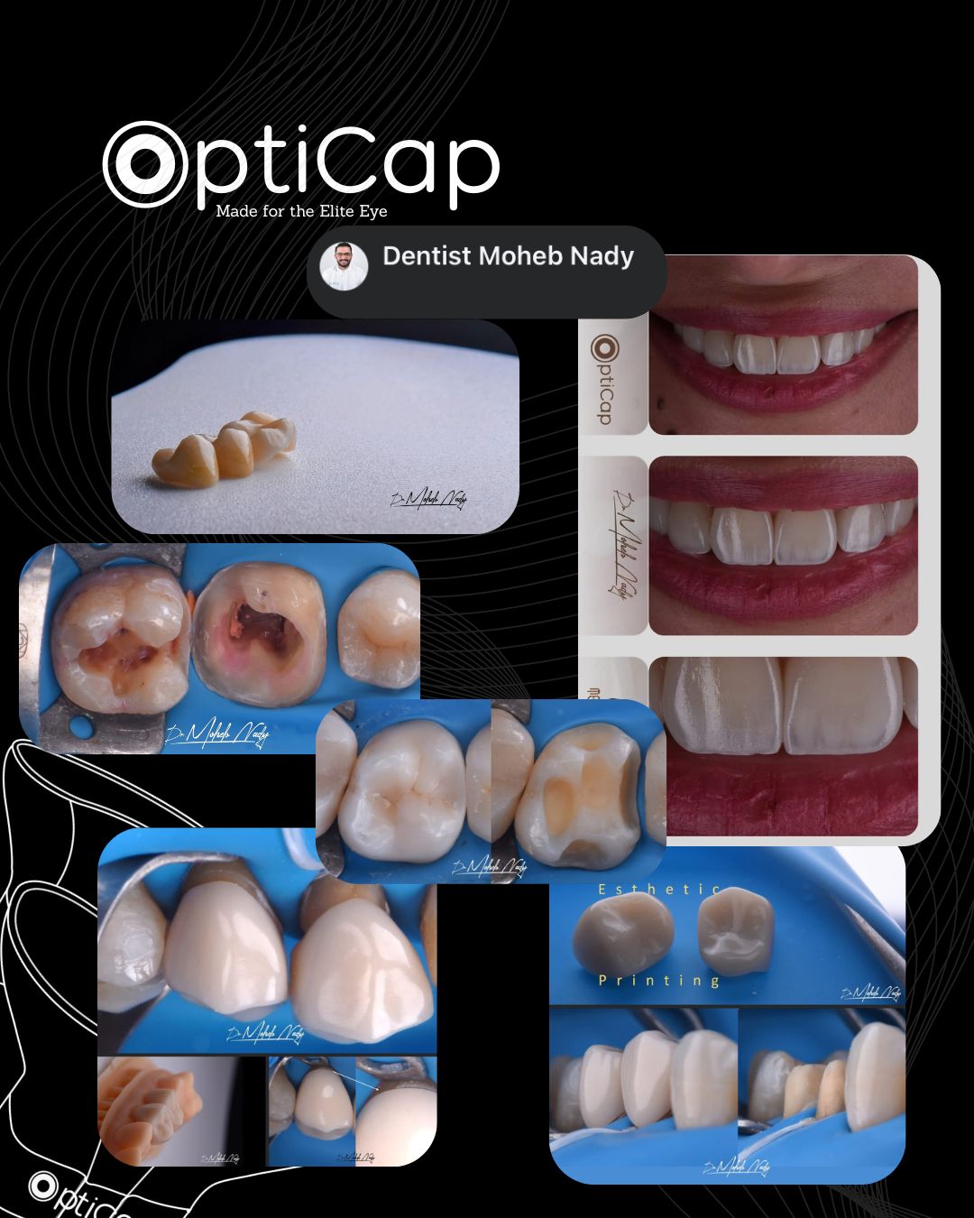 Dr. B. Prosthodontics