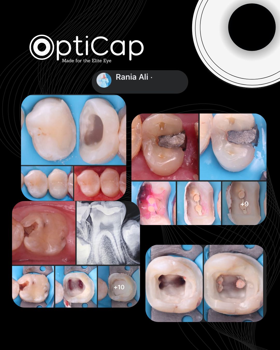 Dr. C. Anterior