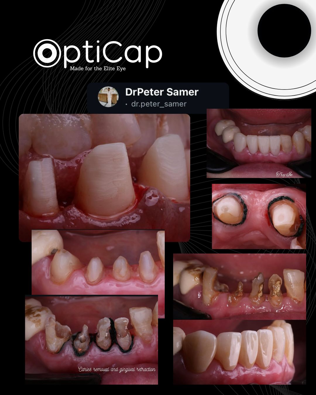 Dr. D. Endodontics